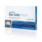 Bio-Gide Perio - это коллагеновая мембрана, получаемая в результате стандартизированного и контролируемого процесса